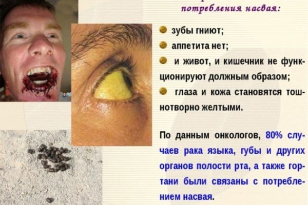 Как зайти на кракен дарк